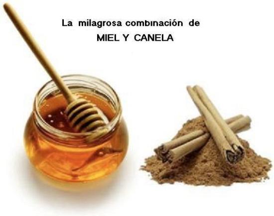 Miel y Canela: Combinación Milagrosa Miel-y-canela-1